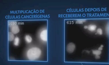 Brasileiro Revoluciona o Combate ao Câncer com Nova Terapia que 'Superaquece' Células Tumorais!